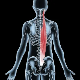 tight erector spinae symptoms, erector spinae strain