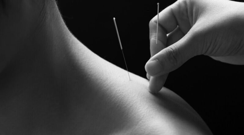 acupuncture for fertility