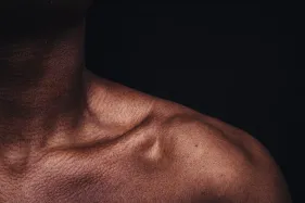 muscle pain under your collarbone