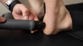 Plantar Fasciitis Edmonton